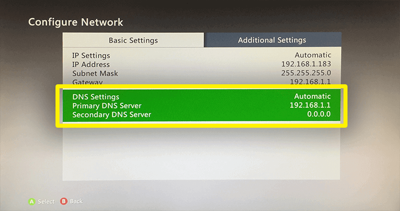 dns xbox one