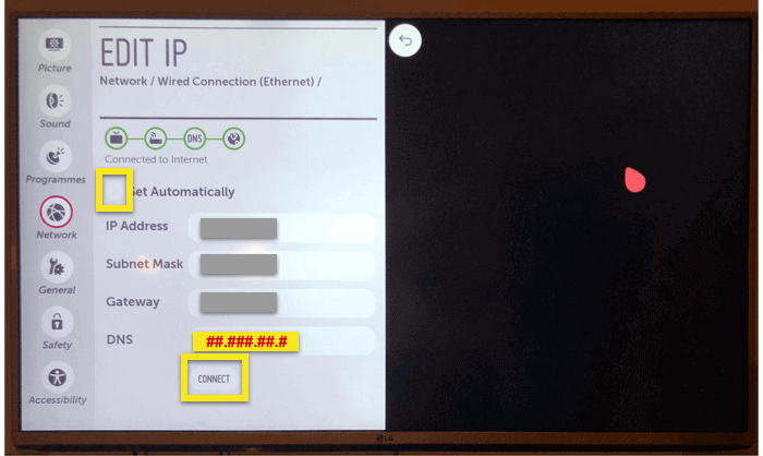 Edit the network settings on your LG Smart TV.